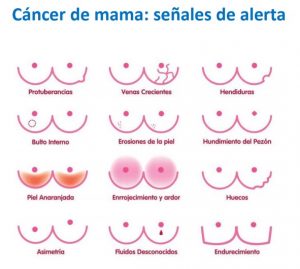 Cambios en los senos a los que hay que prestar atención. Fuente Ministerio de Salud Pública