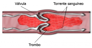 Fuente: Wikipedia
